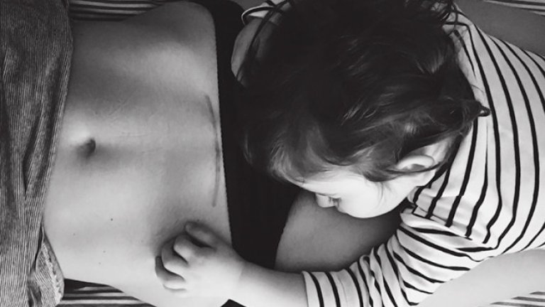 federica-simoni-mamafedora-c-section-scar-little-boy-750x550
