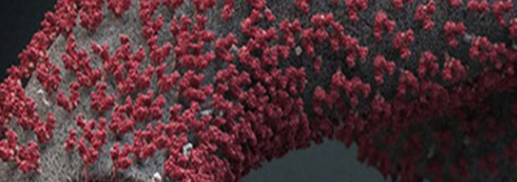 ebola-virus-close-513x239