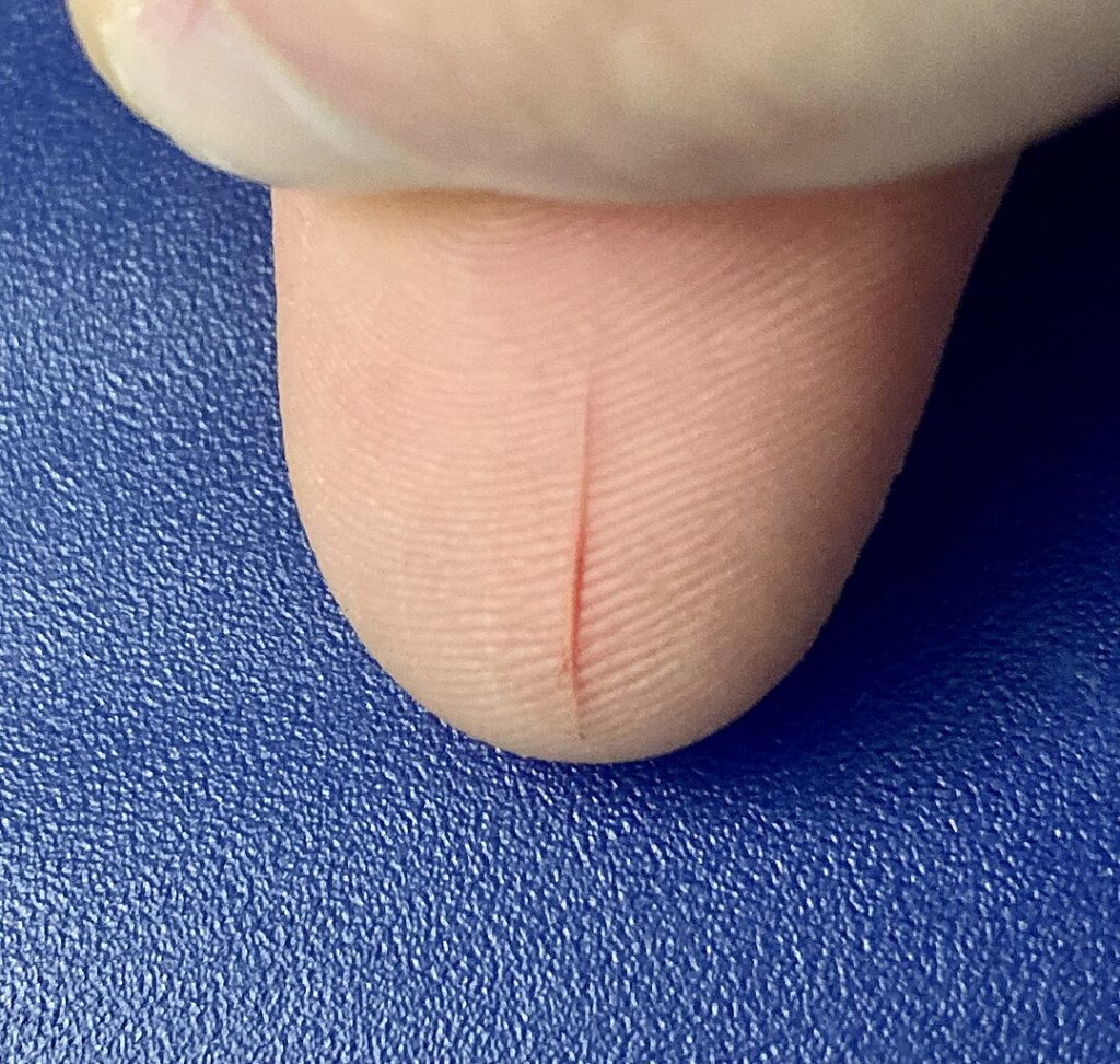 Thumb_Open_Paper_Cut-_photo