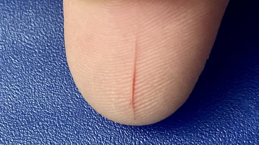 Thumb_Open_Paper_Cut-_photo