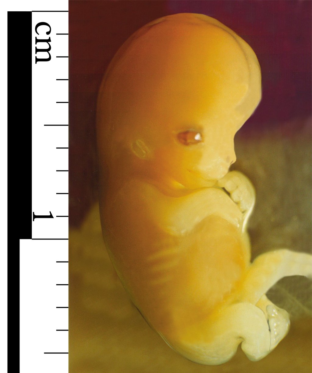 Embryo_7_weeks_after_conception