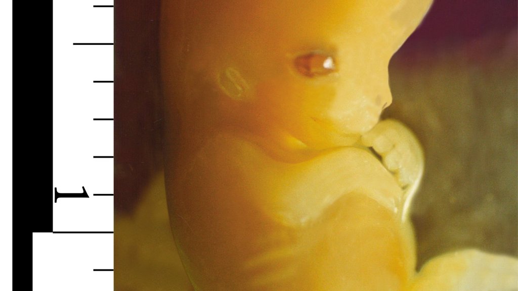 Embryo_7_weeks_after_conception