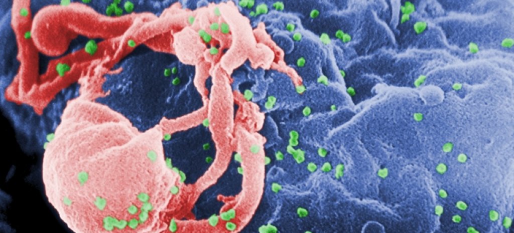 HIV-nov-viid-02
