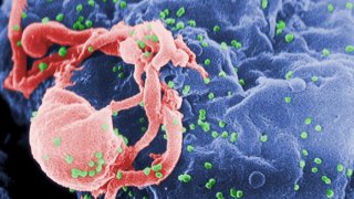 HIV-nov-viid-02