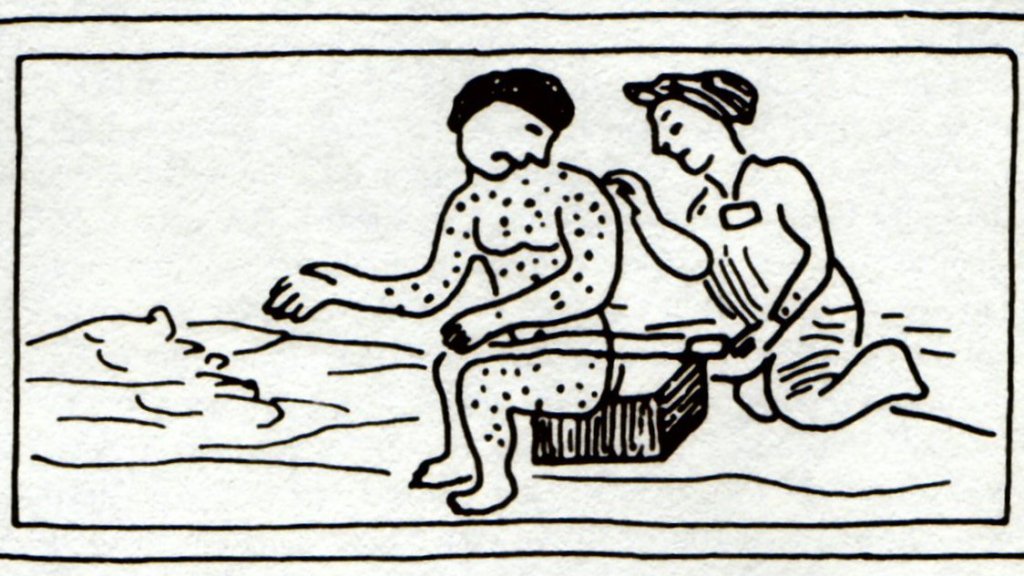 Measles_Aztec_drawing