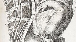 Cephalicpre
