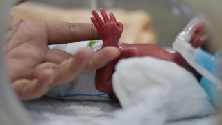 изкуствена плацента недоносване