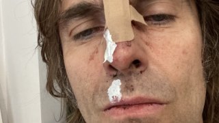 Фронтменът на Oasis посрещна рождения си ден със счупен нос след падане от хеликоптер. Това обаче далеч не е най-запомнящото му се изпълнение