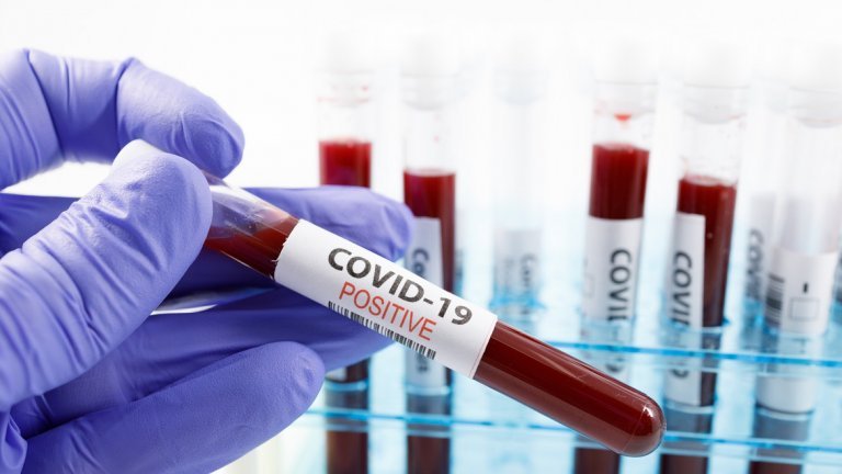 Германска компания тества ваксина срещу COVID-19 върху доброволци