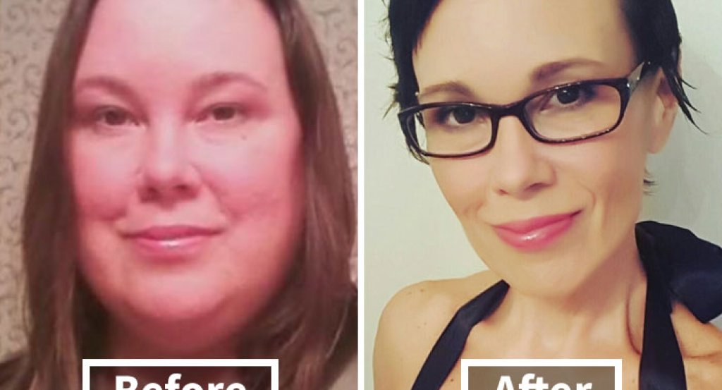 before-after-weight-loss-face-transformation-41-5a1d2b48bba59__700