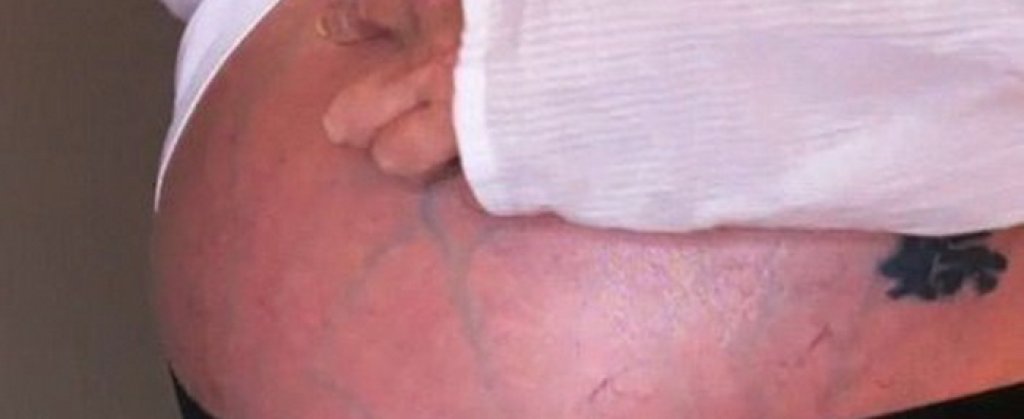 ciroza-demek-trudna-02