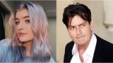 Сами Шийн се реши на първата си пластична операция