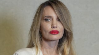 Джоли и преди е споделяла, че страда от рядък вид парализа