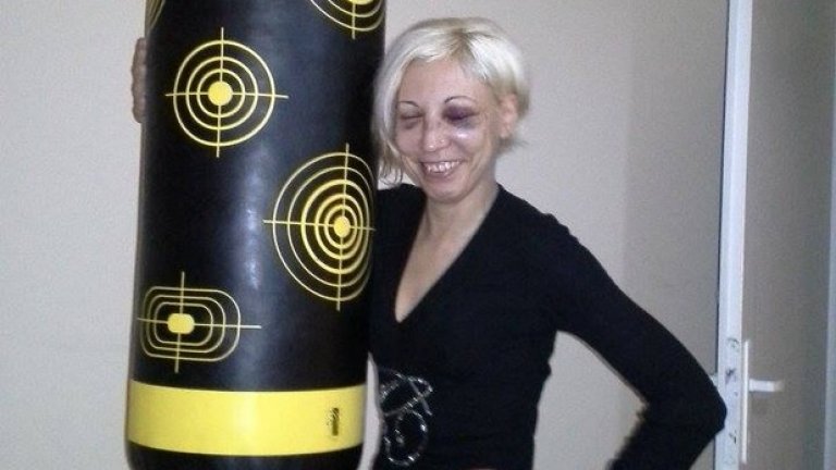 Жена се оплака от полицейско насилие в София