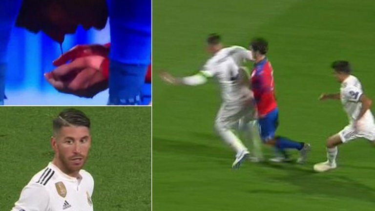 "Футболът винаги те учи на нещо и тази вечер не трябваше да влизам в това единоборство по такъв начин. Милан, нямах намерение да те нараня. Оправяй се бързо", написа защитникът на Реал в Twitter.