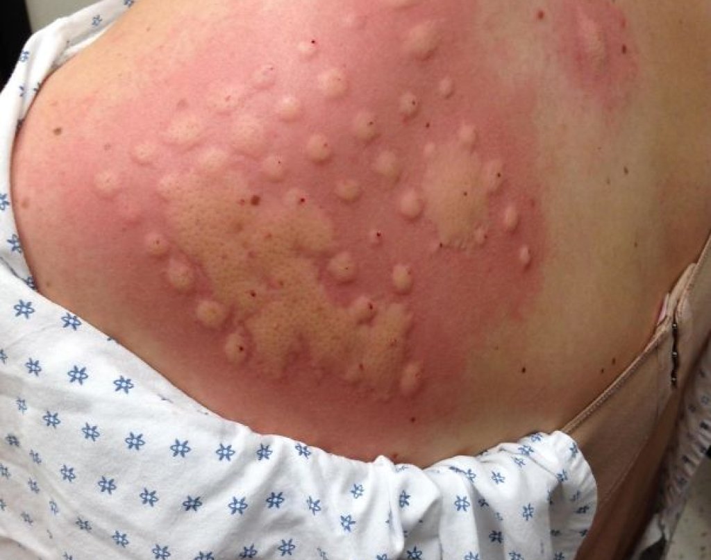 Тест за алергия, който показва, че си алергичен на практика към всичко...