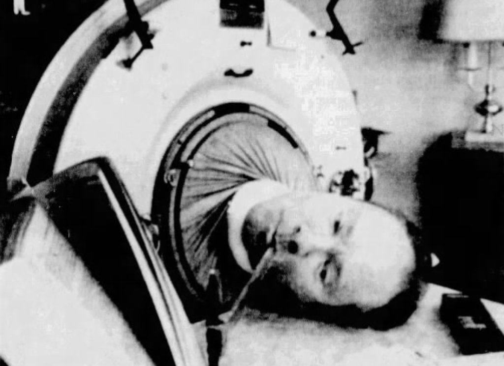 Paul_Alexander_(polio_survivor)