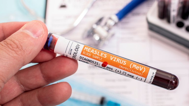 Министерството съветва родителите да проверят дали детето има нужните имунизации