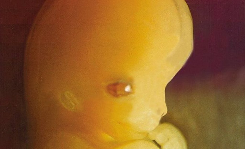 859px-Embryo_7_weeks_after_conception