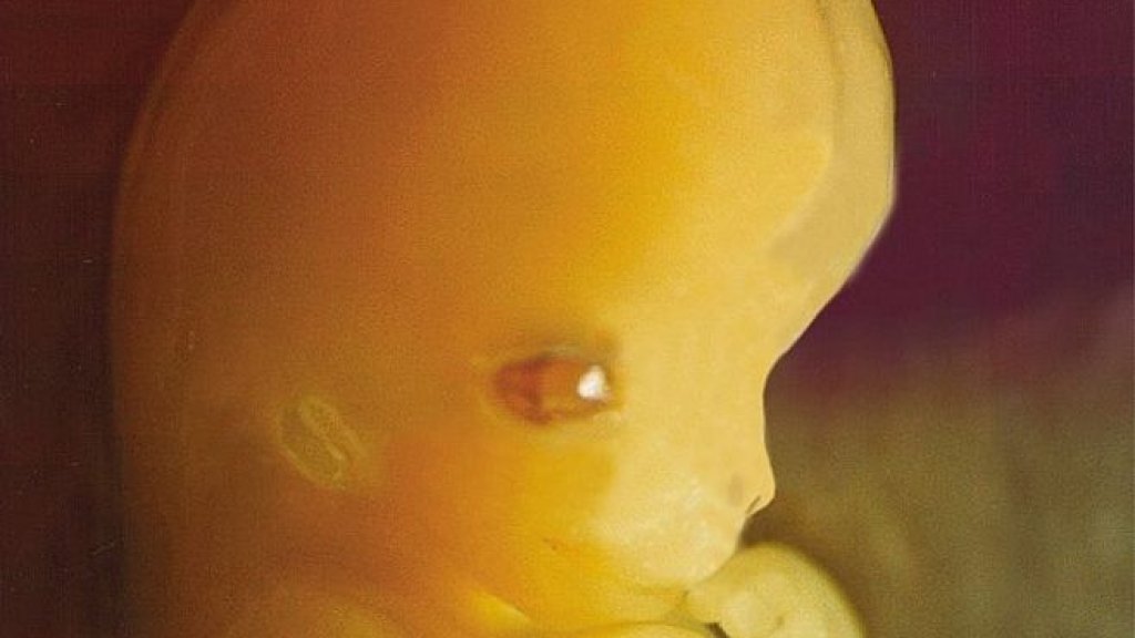 859px-Embryo_7_weeks_after_conception