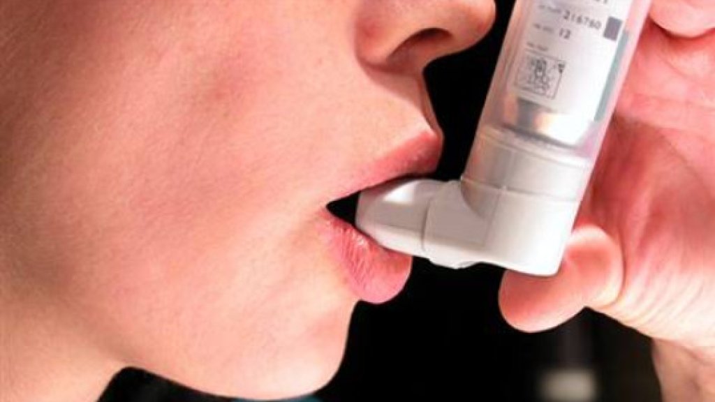asthma