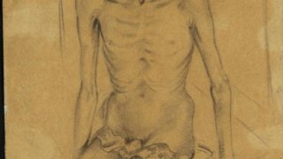 Dysentery_Patient,_Burma_Hospital,_Siam_Art.IWMART1541787