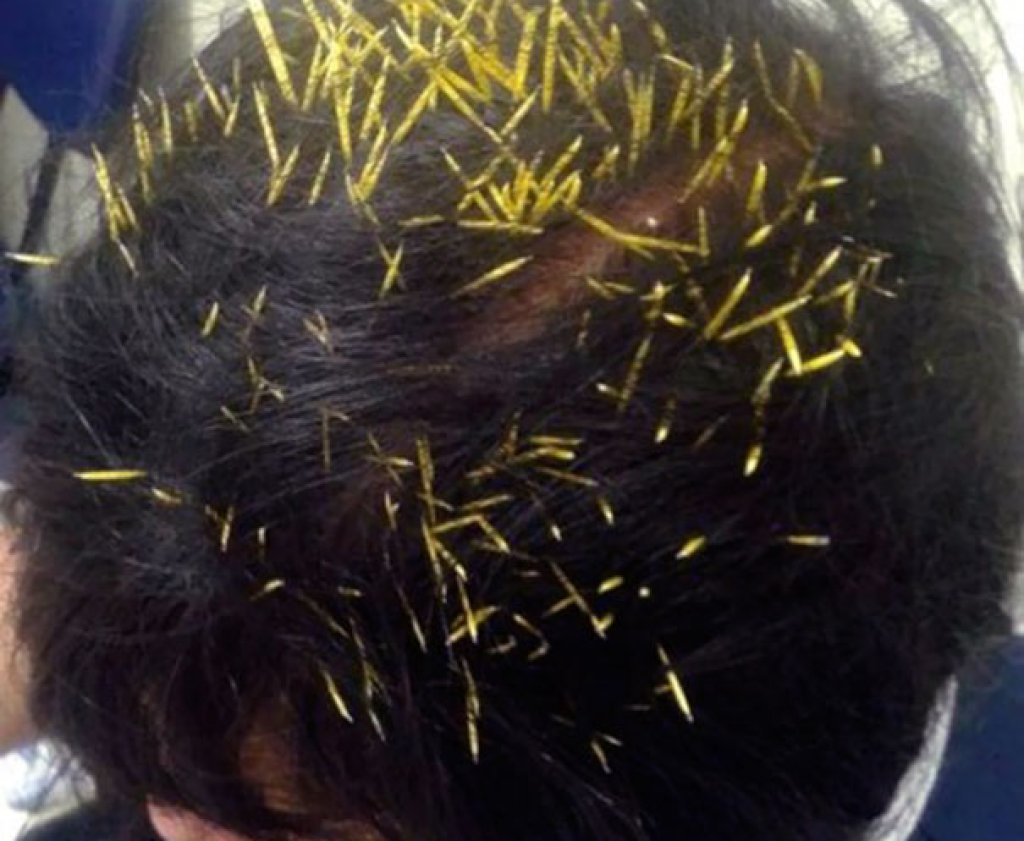 Да ти падне таралеж на главата!