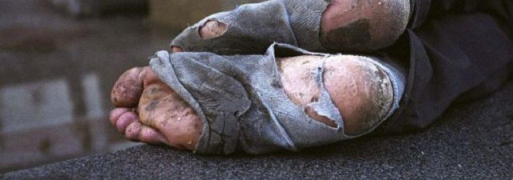 homeless-feet1