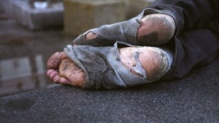 homeless-feet1