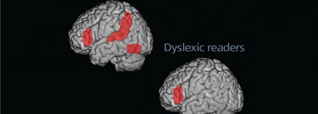 Dyslexia Today