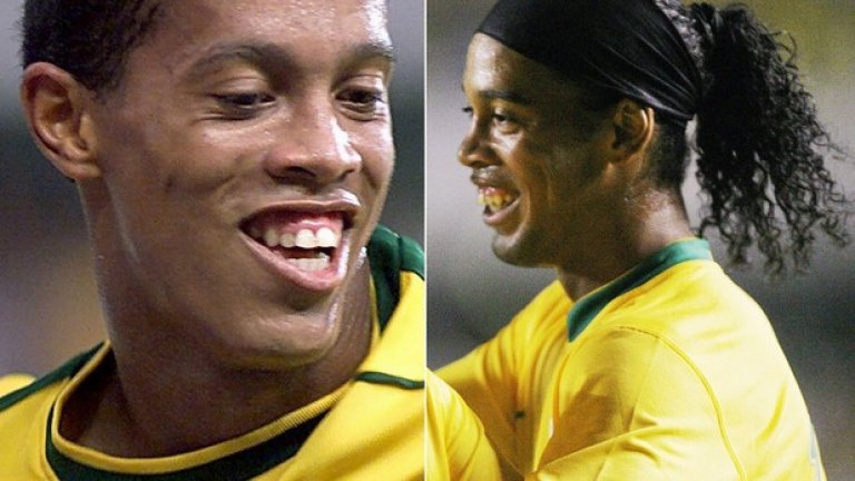 Зъбите на Роналдиньо добиха легендарен статут и му спечелиха прякора Заека. През 2013 г. бразилецът се бръкна с 50 000 евро за нова усмивка.