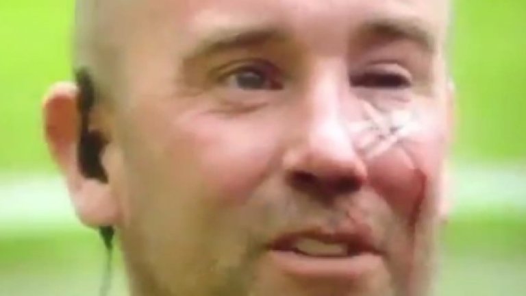 Протестиращите на "Олд Трафорд" раниха полицай, оставиха му белег за цял живот (видео)
