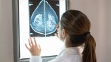 В България ежегодно една на осем жени е диагностицирана с рак на гърдата