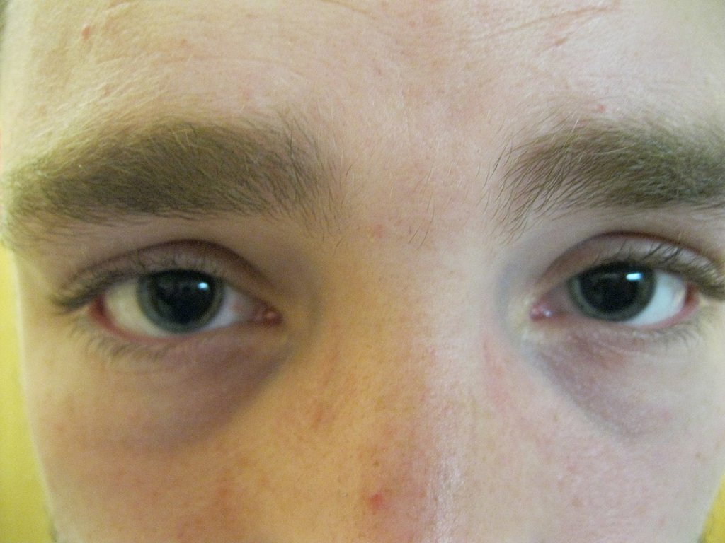 Pupils,_please_try_and_realise_what_this_means,_the_lights_are_on,_but_the_pupils_are_wide._(35388750002)