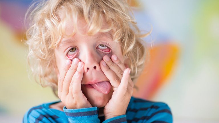 дете, физиономия