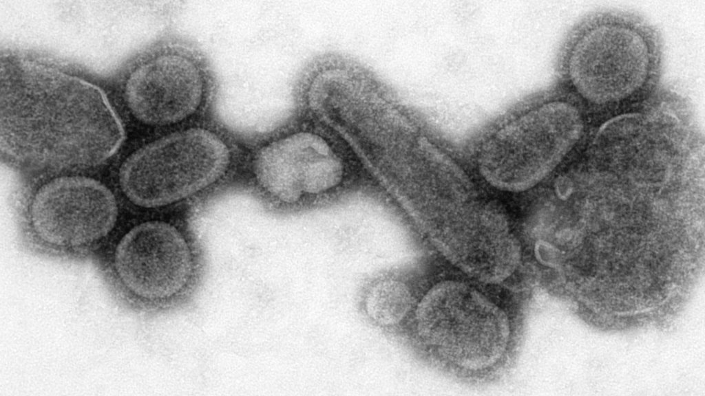 Reconstructed_Spanish_Flu_Virus