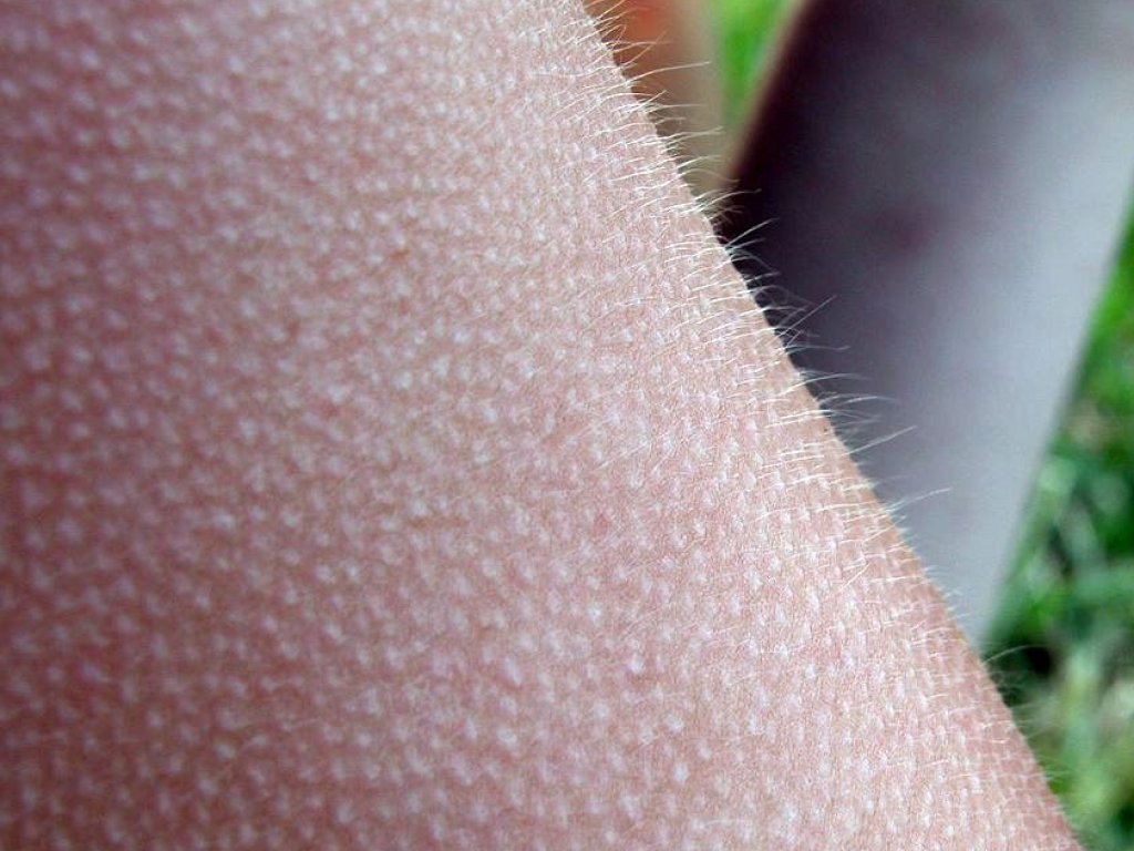 841px-2003-09-17_Goose_bumps