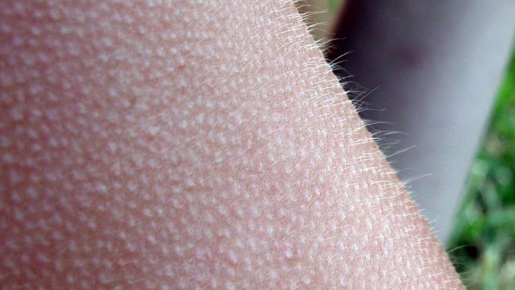 841px-2003-09-17_Goose_bumps