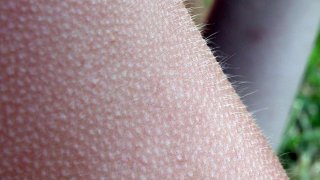 841px-2003-09-17_Goose_bumps
