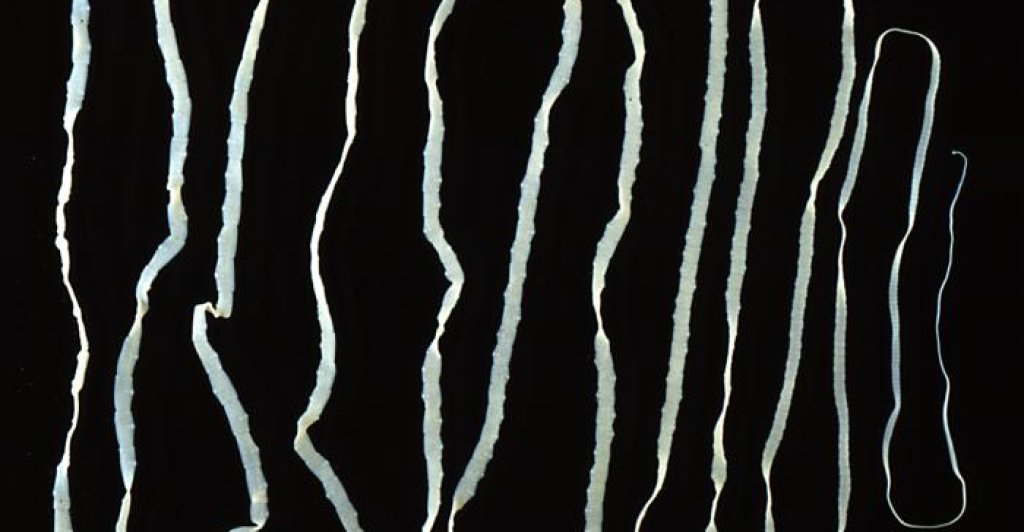Taenia_saginata_adult_5260_lores