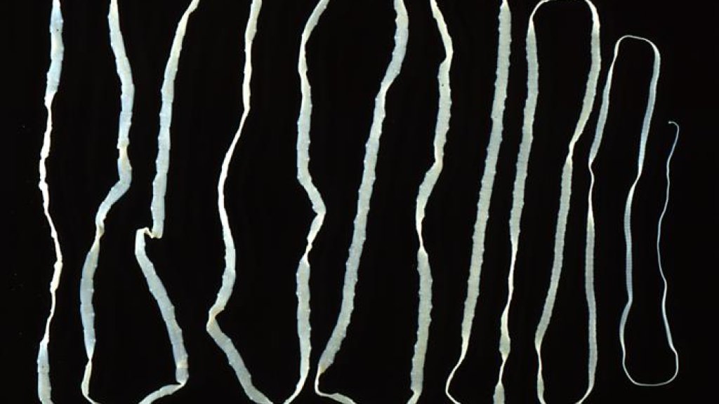 Taenia_saginata_adult_5260_lores