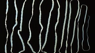 Taenia_saginata_adult_5260_lores