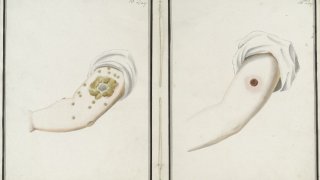 Inoculation_day_16