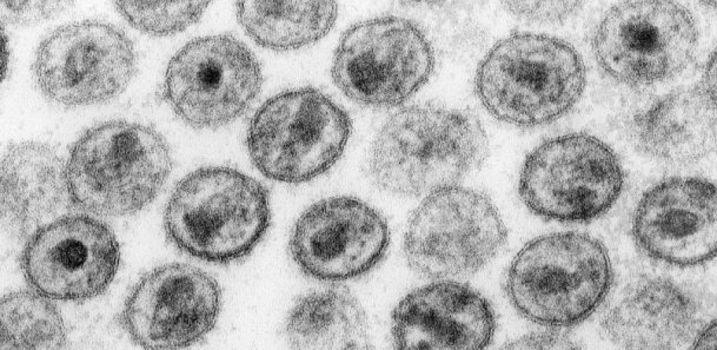 HIV-1_Transmission_electron_micrograph_AIDS02bbb_lores