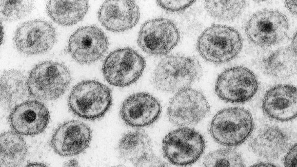 HIV-1_Transmission_electron_micrograph_AIDS02bbb_lores
