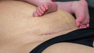 Ако никога не сте преживявали секцио, може да не знаете какво да очаквате, когато се възстановявате от операцията