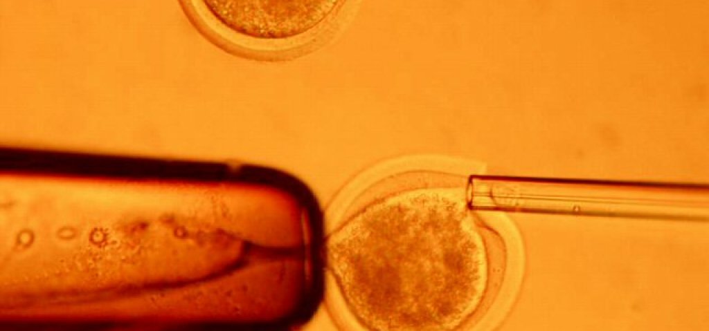 12181339000_61000010