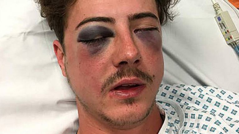 Инцидентът с 23-годишния мъж се е случил след полуфинала за ФА къп между Тотнъм и Челси в събота, спечелен от "сините" с 4:2.