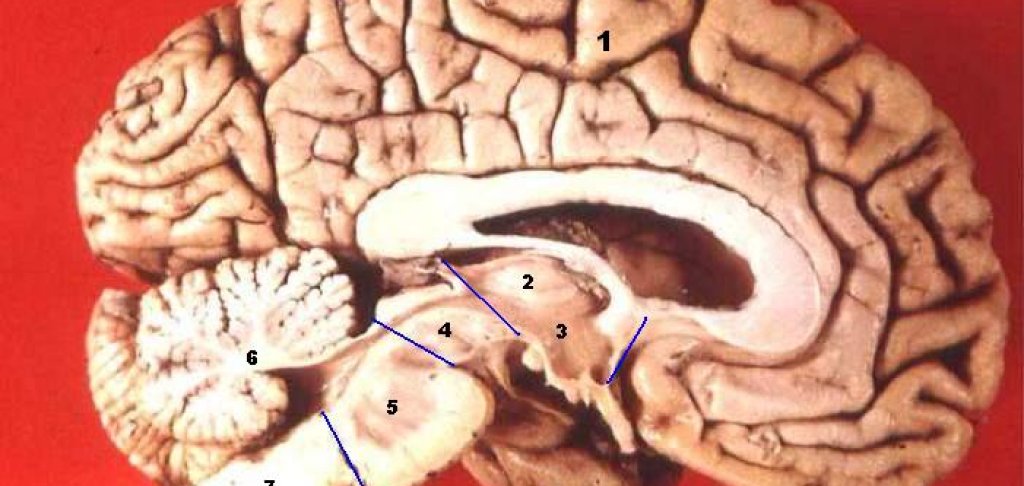 Human_brain_midsagittal_cut_description