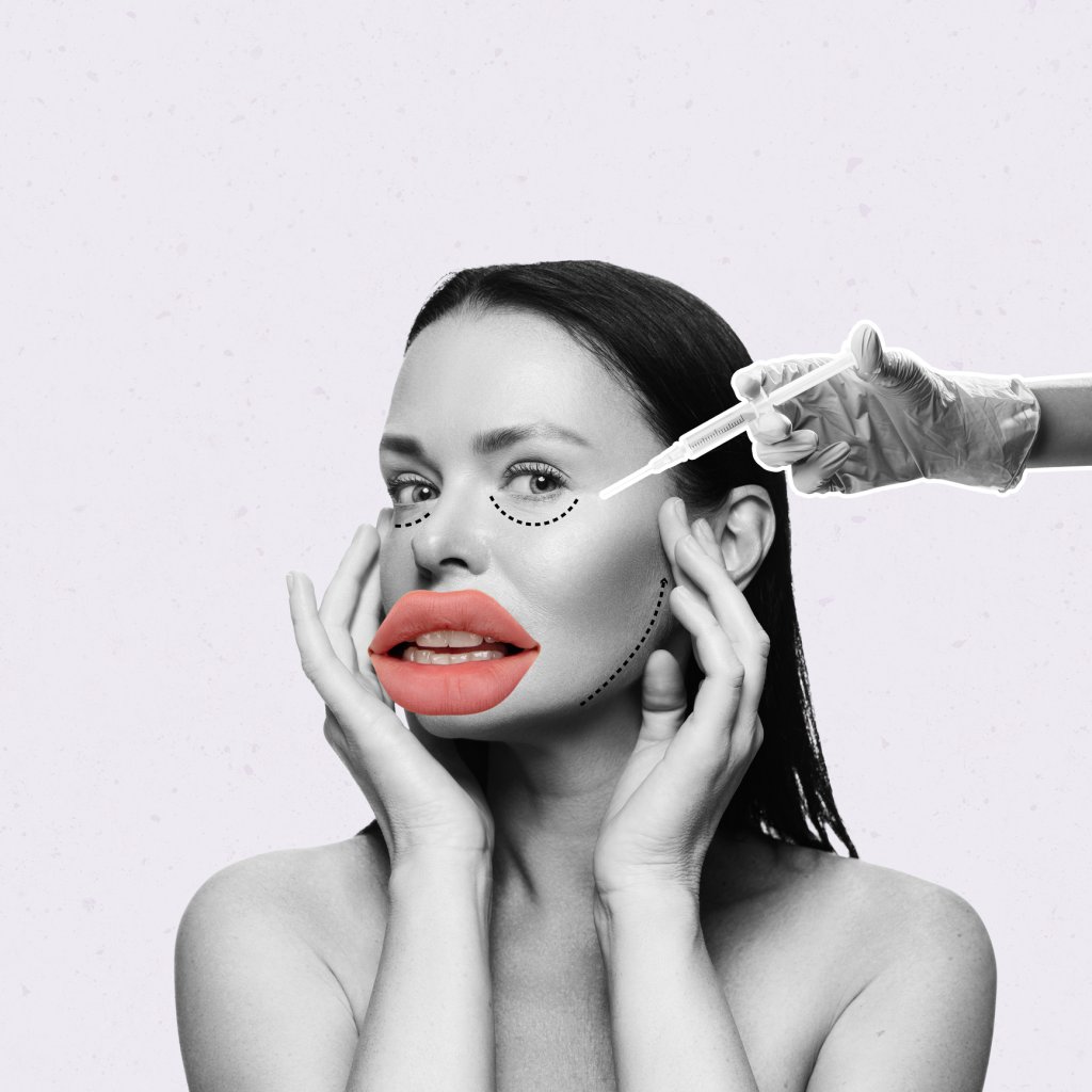 Contemporary art collage. Woman doing face lifting with hyaluronic acid fillers. Anti aging care. Lip augmentation